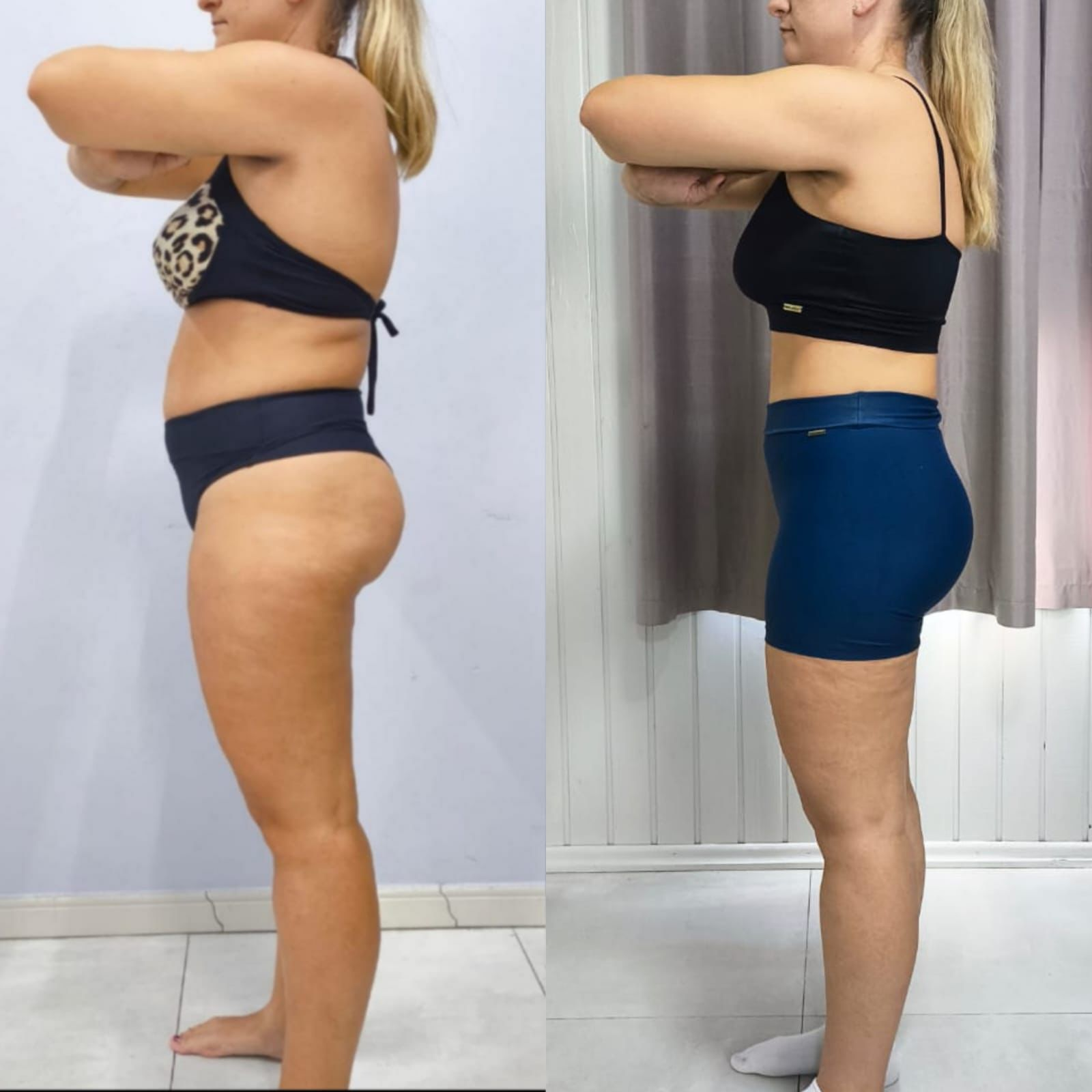 Depoimento 13